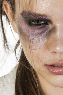 国内代孕服务时突然头晕目眩冒汗的原因分析 国内代孕服务时突然头晕目眩冒汗的原因分析